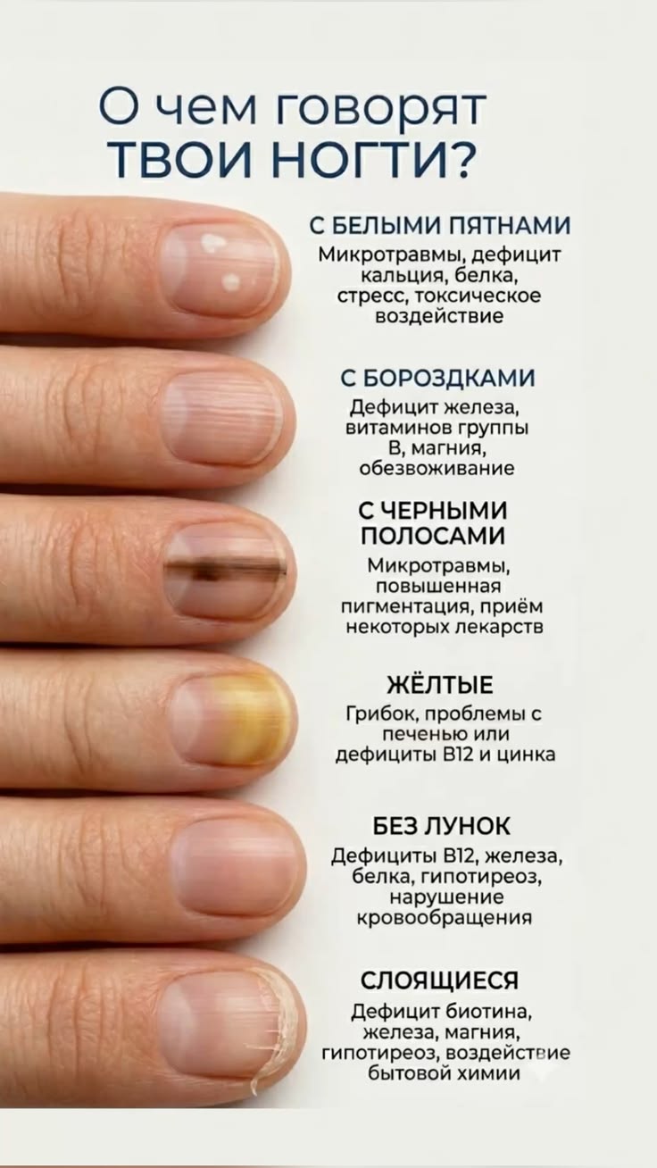 О чем говорят ваши ногти: зеркало внутреннего состояния организма